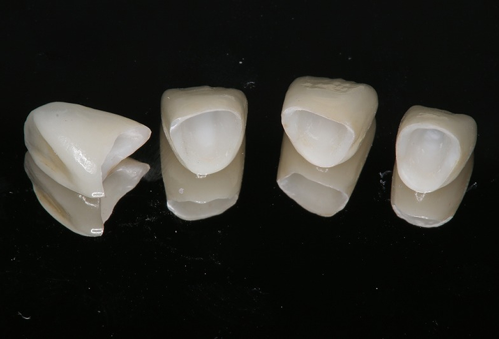 ③オールセラミック作製