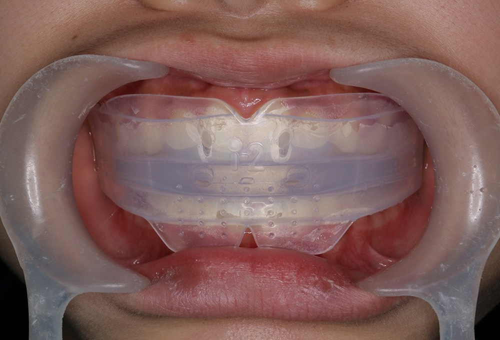 ④トレーナー使用