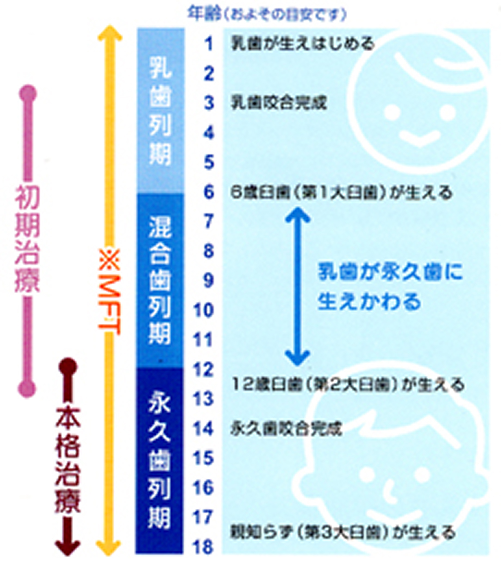 小児の矯正治療