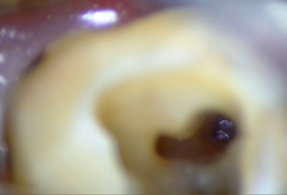 ②マイクロスコープを使用して破折ファイル確認